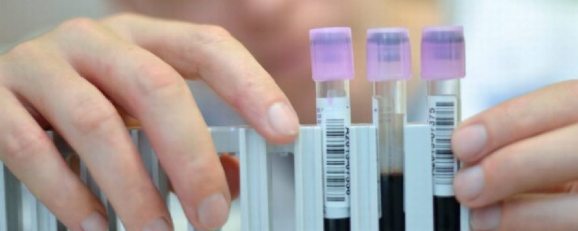 Blitz antidoping in 40 province: nelle indagini anche Teramo